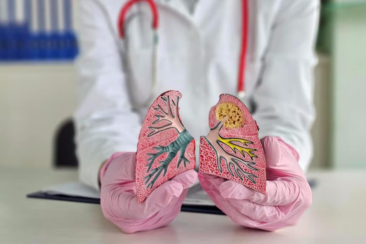 Un médecin qui montre des poumons